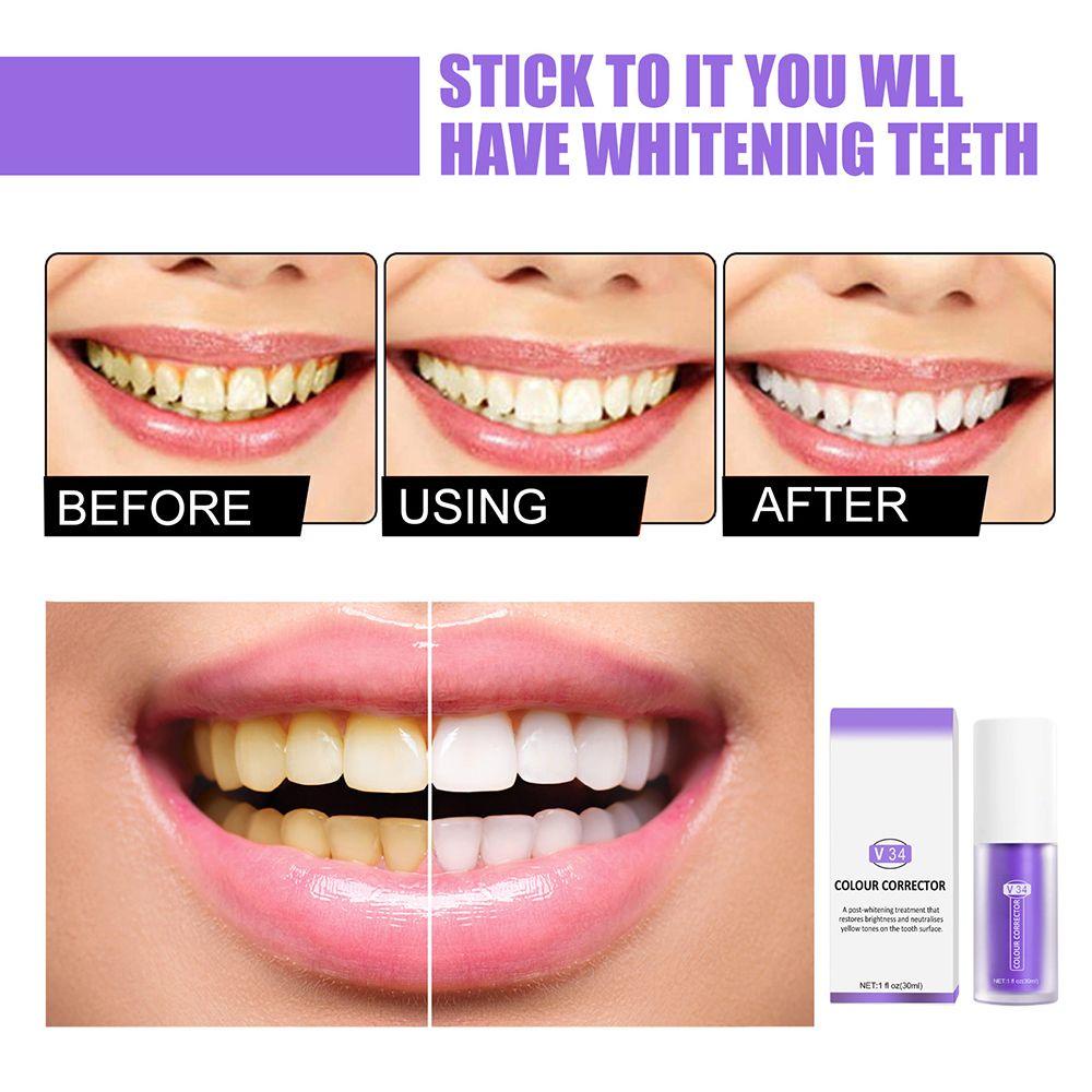Kem Đánh Răng SUMU V34 Chỉnh Sửa Răng Miệng Thoáng Khí Làm Sạch Nhạy Cảm