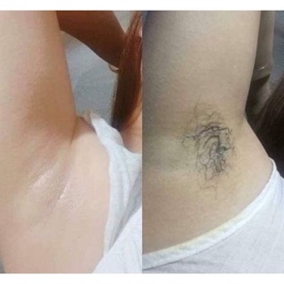 KEM TẨY LÔNG KONE THÁI