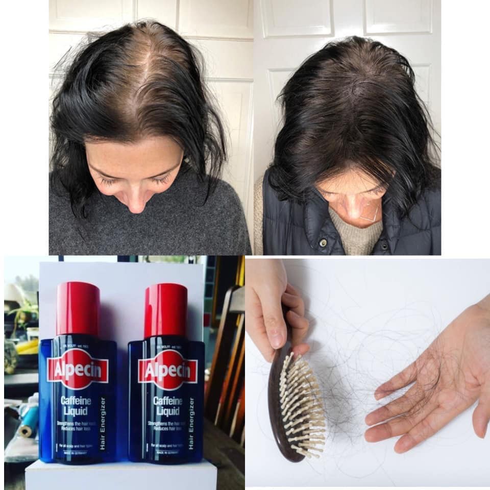 Bộ dầu gội & tinh dầu kích mọc tóc Alpecin