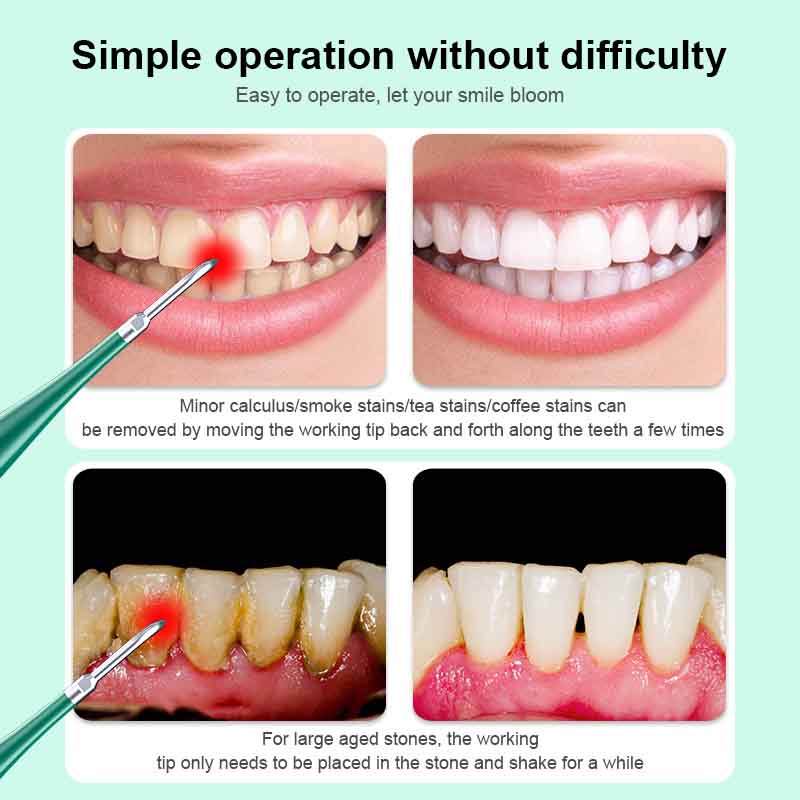 Máy lấy cao răng tại nhà Gumcare Wireless Toothbrush,máy 2 in 1 lấy vôi răng kèm đánh răng sạc đế không dây