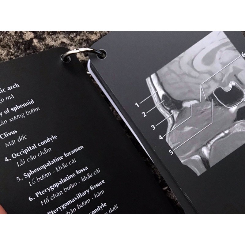 FA Xquang Head and Neck