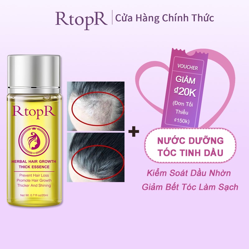 Tinh chất dưỡng tóc RtopR hỗ trợ kích thích mọc tóc ngăn rụng tóc và giúp mọc tóc phục hồi tóc hư tổn 20ml