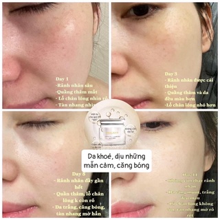 Ủ MẶT PHỤC HỒI NẤM TRUFFLE