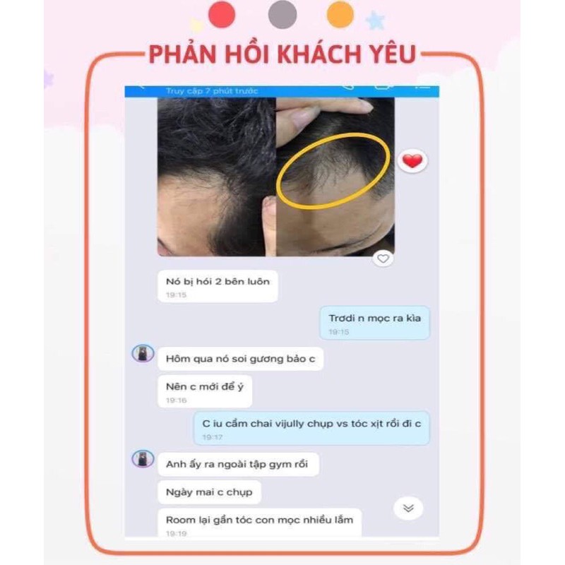 [MỌC TÓC NHANH] TINH DẦU BƯỞI XỊT TÓC VIJULLY 100ml, NGĂN NGỪA RỤNG, KÍCH THÍCH MỌC TÓC | BigBuy360 - bigbuy360.vn