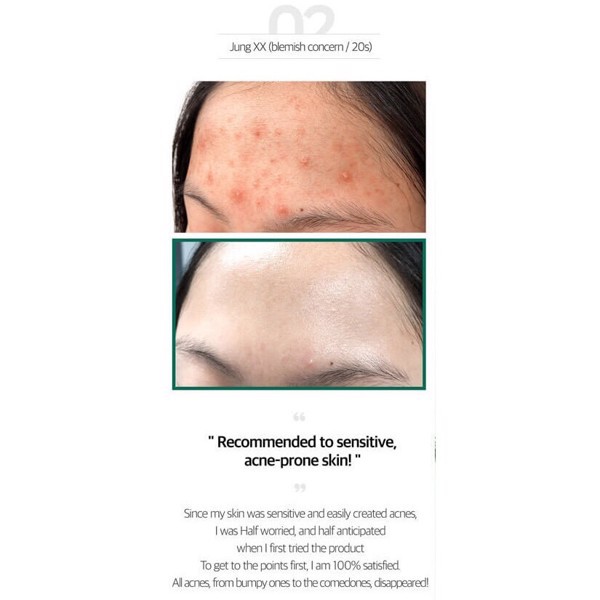 Bông tẩy da chết Some By Mi AHA-BHA-PHA 30 Days Miracle Truecica Clear Pad 70 miếng