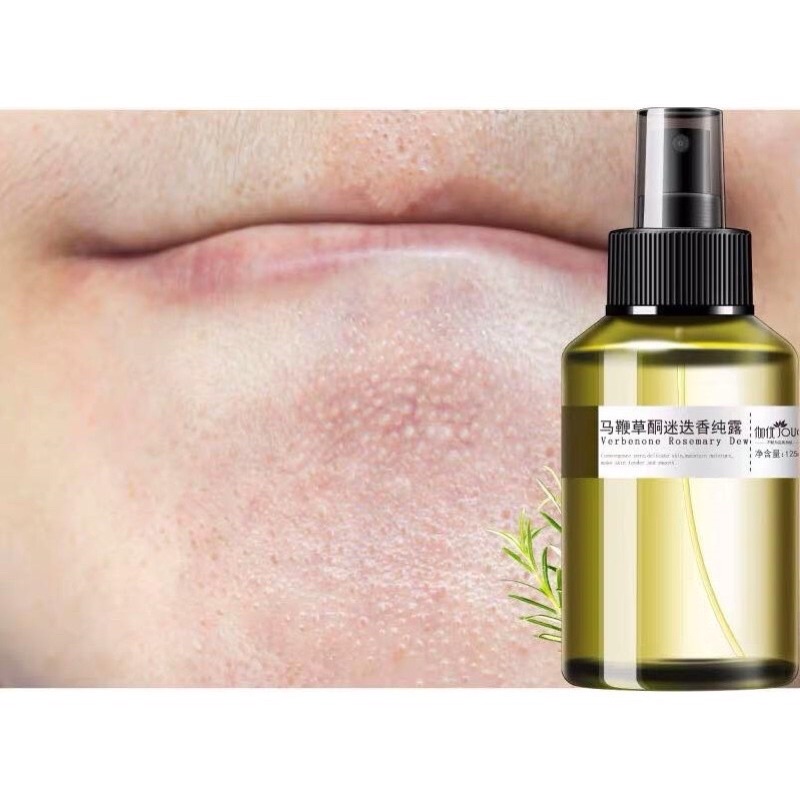 TONER XỊT Ủ MỤN GIÚP NGỪA MỤN BỌC MỤN TRỨNG CÁ toner verbenone rosemary | BigBuy360 - bigbuy360.vn