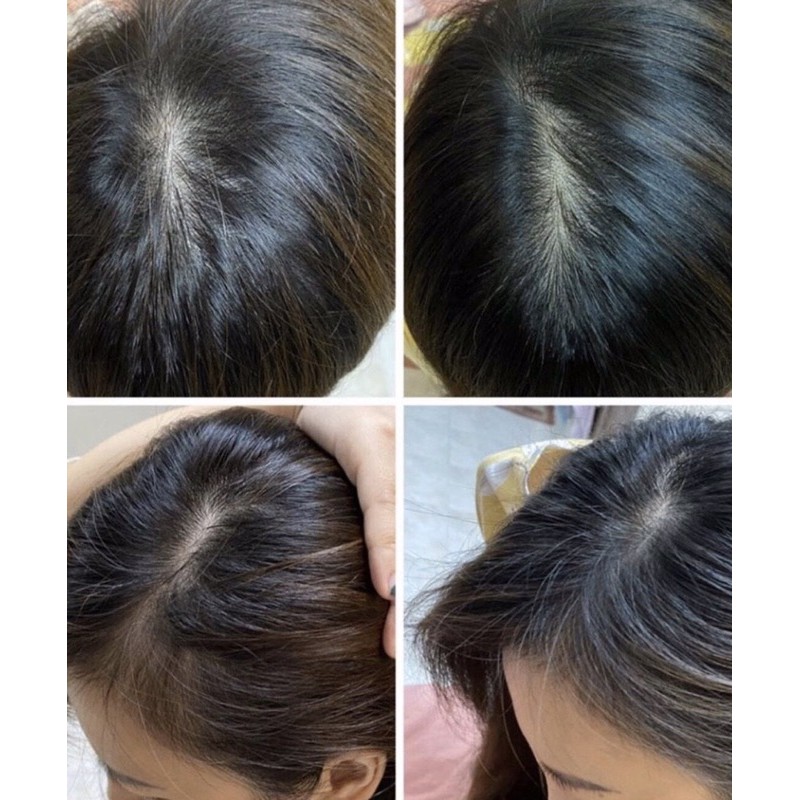 Dầu dưỡng tóc Vaseline Hair Tonic 100ml