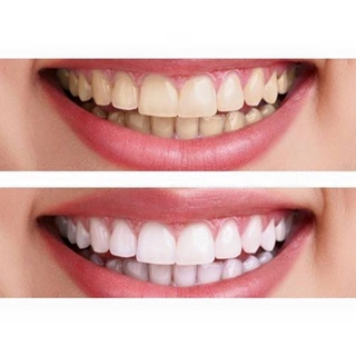 KEM ĐÁNH TRẮNG RĂNG EUCRYL TOOTHPASTE ANH QUỐC