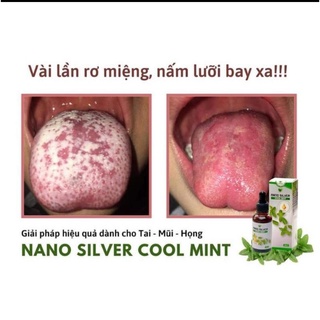 [MUA 1 TẶNG 1]NANO SILVER COOL MINT