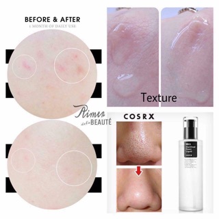 Tinh chất COSRX BHA BLACKHEAD POWER LIQUID
