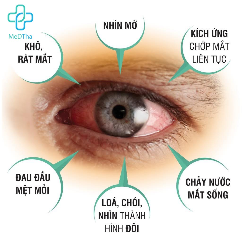 Wit - Bảo vệ võng mạc và thủy tinh thể, Tăng cường thị lực, giảm mờ, mỏi mắt [Chính Hãng]