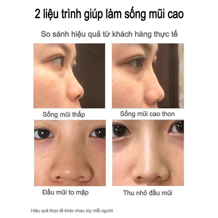 Tinh dầu nâng mũi 10ml serum cao mũi tự nhiên, làm đẹp mũi, thu nhỏ cánh mũi, tạo cao dáng mũi