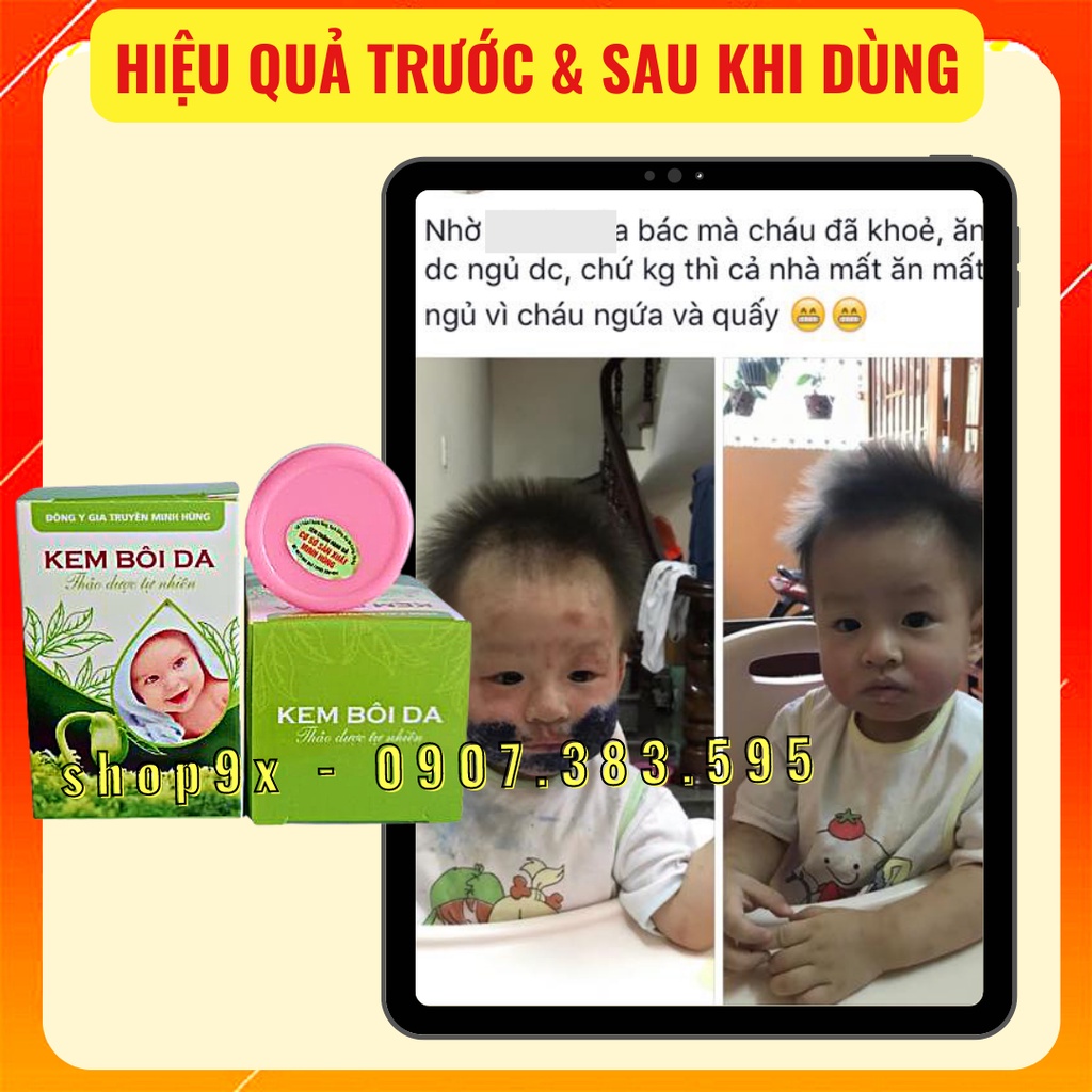 Kem Bôi Da Minh Hùng Chính Hãng - Kem Dưỡng Ẩm Da Bé // Shop9x