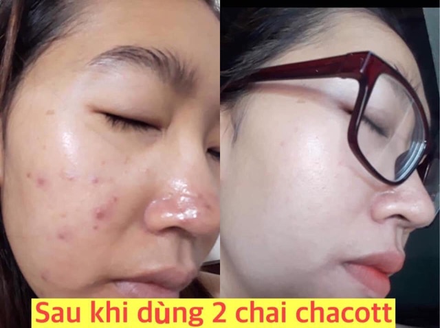 [MẪU MỚI] NƯỚC TẨY TRANG CHACOTT FOR PROFESSINALS 500Ml