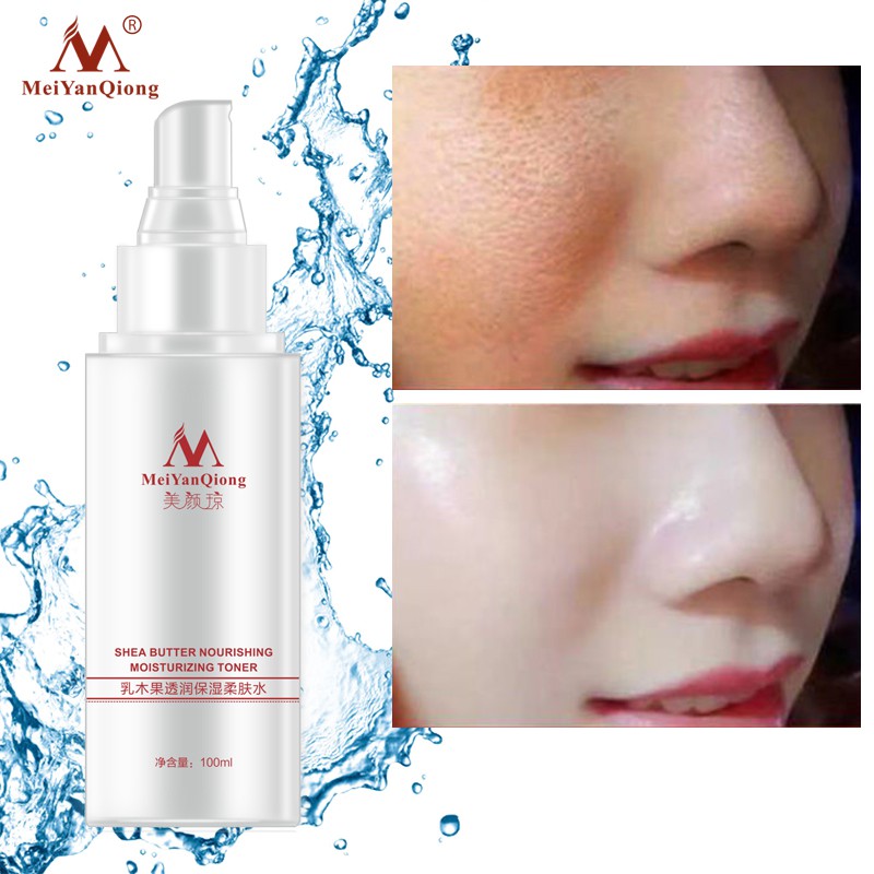 Nước Hoa Hồng MeiYanQiong Tinh Chất Bơ Hạt Mỡ Axit Hyaluronic Dưỡng Ẩm Làm Trắng Da 100ml