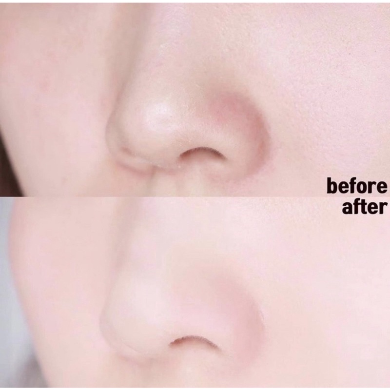 Thanh Lăn Mụn Đậu Đen Se Khít Lỗ Chân Lông Red Peel Clear Stick