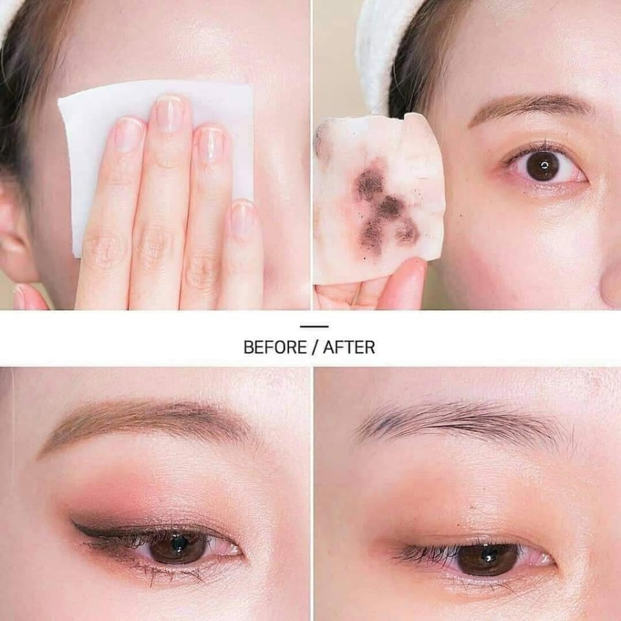 (Mẫu mới) Nước Tẩy Trang Cho Da Dầu Mụn SVR Sebiaclear Eau Micellaire 400ml