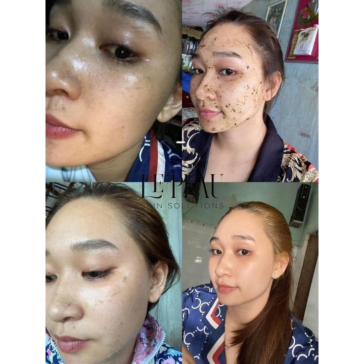 LE’PEAU - Peel da Vi Tảo Retinol chính hãng