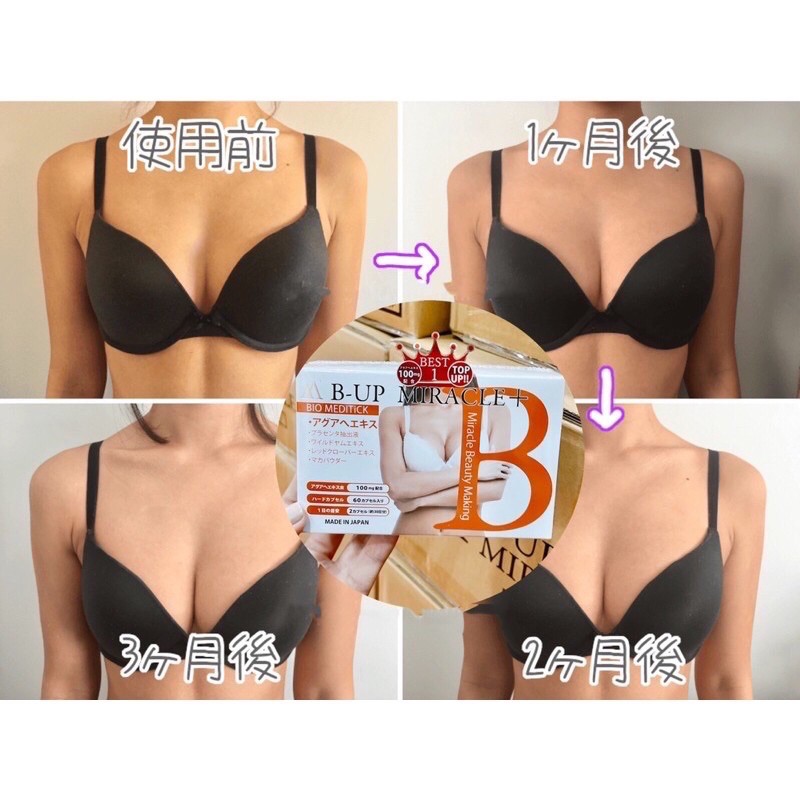 NỞ NGỰC B UP MIRACLE | BigBuy360 - bigbuy360.vn