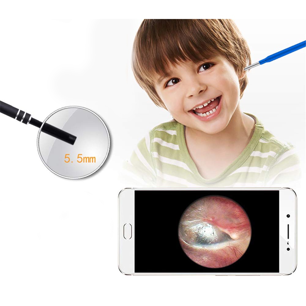 Camera Nội Soi Siêu Nhỏ Xem trực tiếp trên điện thoại siêu tiện lợi, không dây đau rát + Tăng kèm đầu lấy ráy tai