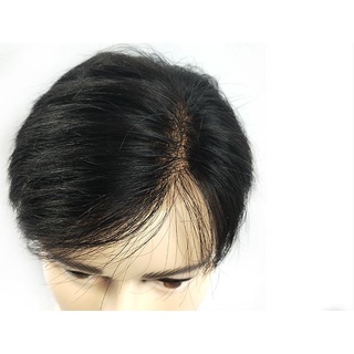 Tóc Giả Nam Dán Vào Da Đầu, Tóc Gi ả Che Mái Hói Cho Nam