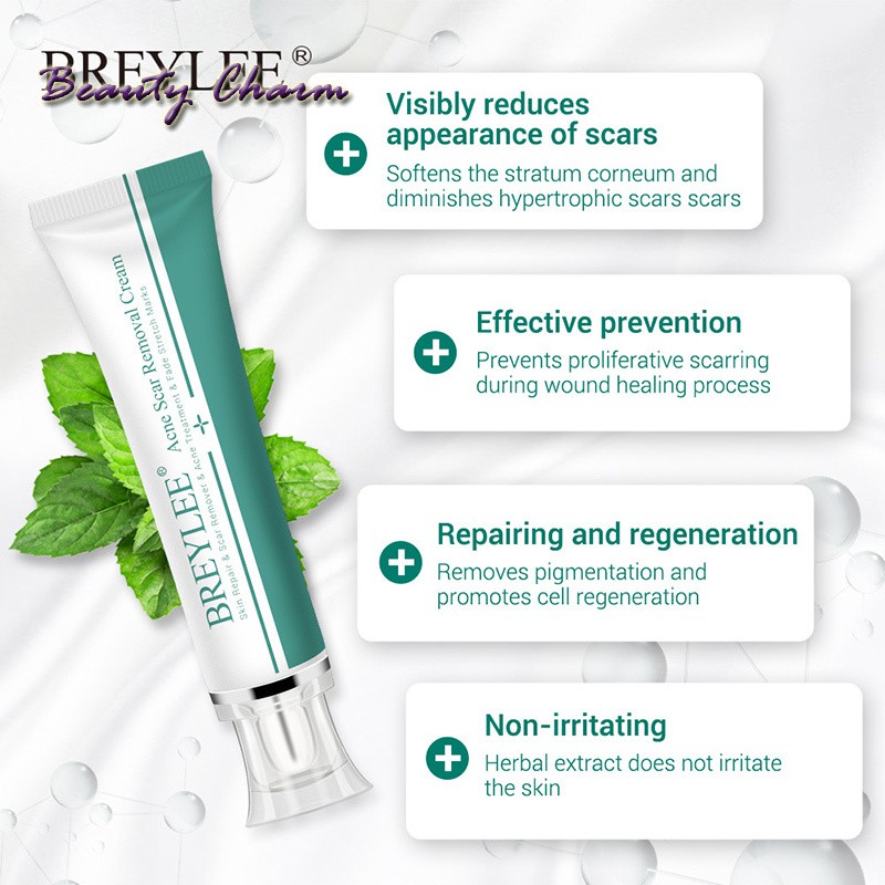 [Hàng mới về] Kem Hỗ Trợ Giảm sẹo 30ml chuyên dụng | BigBuy360 - bigbuy360.vn