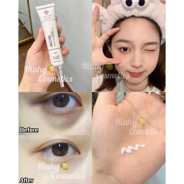 Kem Mắt Cha Skin Snail Wrinkle