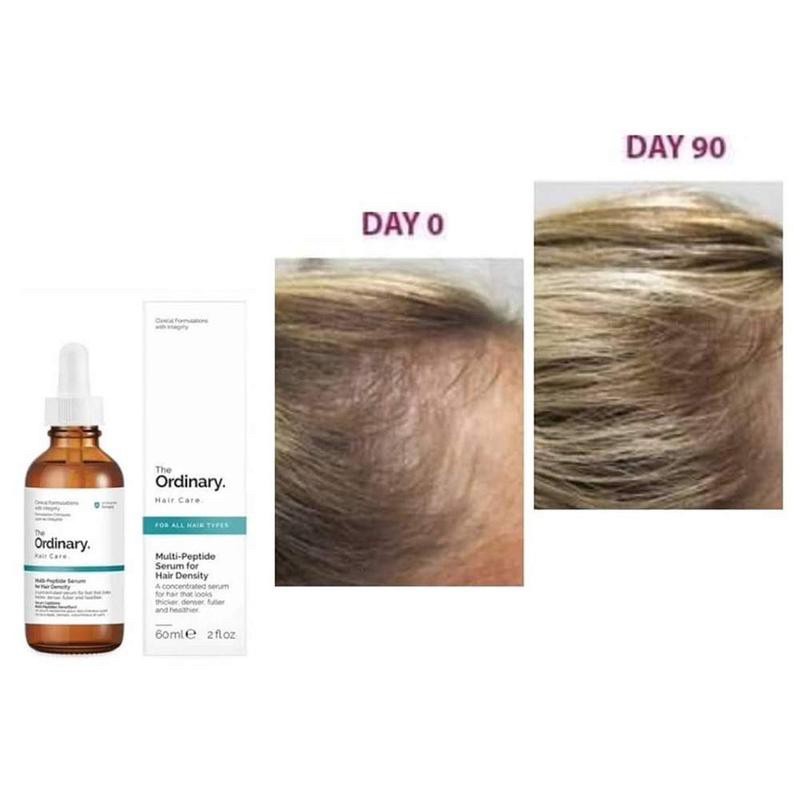 The Ordinary Multi-Peptide Serum For Hair Density 60 - Serum, dầu dưỡng tóc  | TheFaceHolic.com