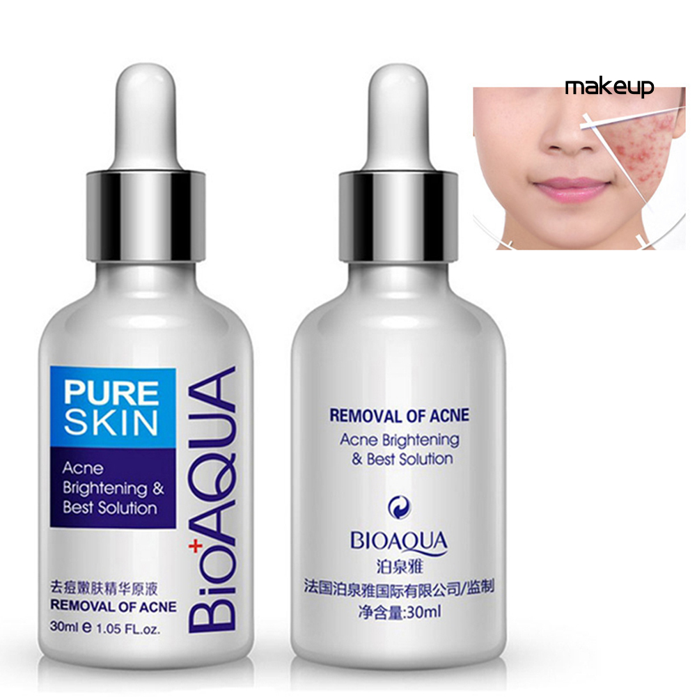 (Hàng Mới Về) Tinh Chất Trị Mụn Kiềm Dầu Dưỡng Ẩm Chăm Sóc Da Bioaqua 30ml