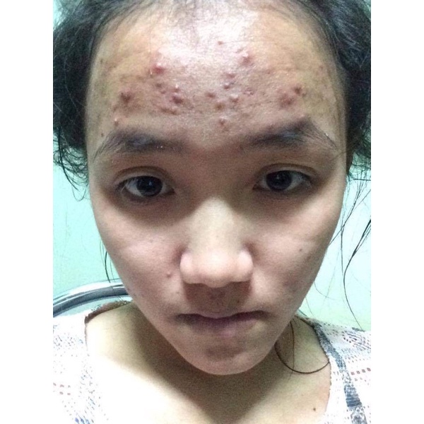 Tinh Chất Tái Tạo tạo da cao Cấp
