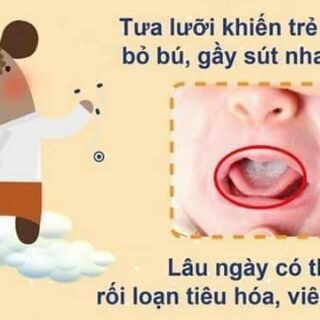 Rơ lưỡi , bàn chải đánh răng cho bé