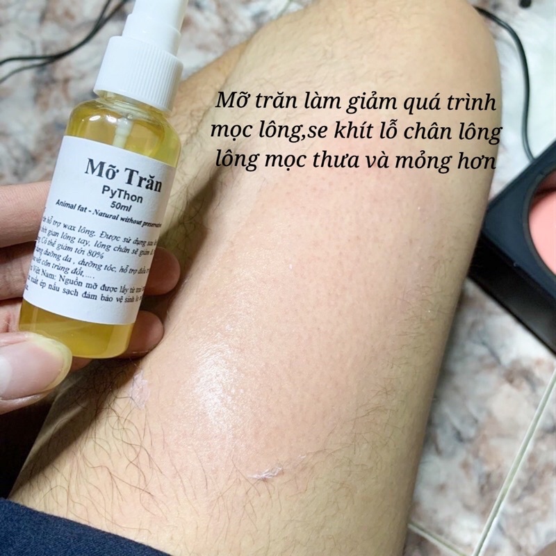 [Hàng chuẩn loại 1]Mỡ trăn thiên nhiên- Mỡ trăn nguyên chất làm giảm quá trình mọc lông