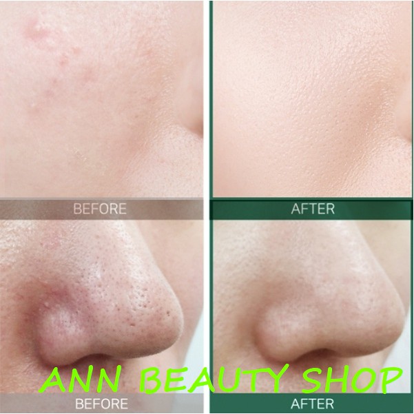 Kem Dưỡng Cho Da Mụn Some By Mi AHA-BHA-PHA 30 Days Miracle Cream