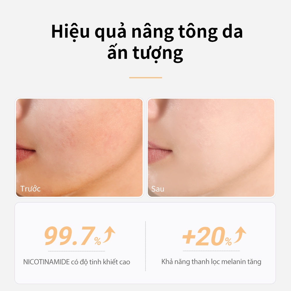 Hàng Giao NgayTinh Chất Làm Trắng Serum Niacinamide Lanbena Làm Sáng Da Giảm Vết Thâm Và Làm Săn Chắc Da 30ml