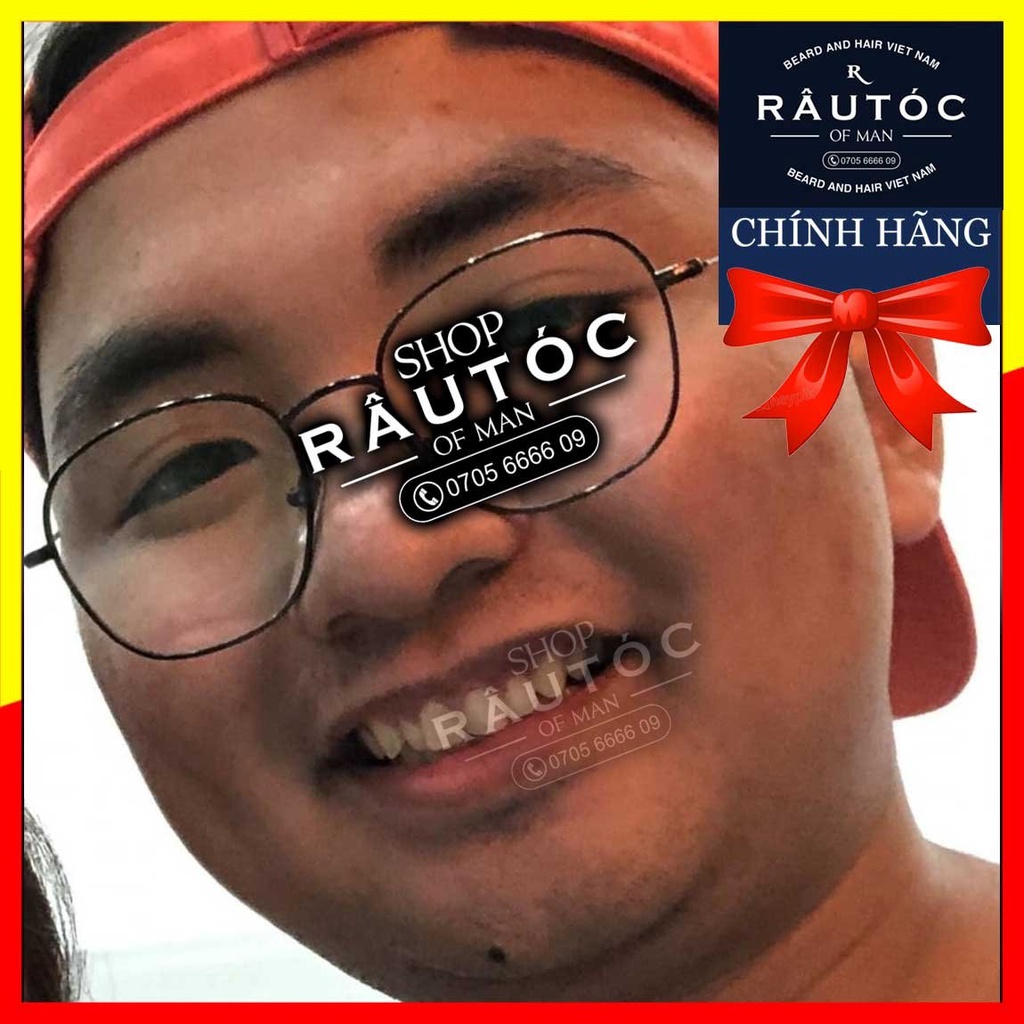 Mọc tóc Hair4U Pro