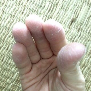 CB 3 LỌ TRỊ VIÊM DA. NẤM. TỔ ĐỈA