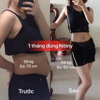 GIẢM CÂN NHỎ CUỐNG RỐN NITINY