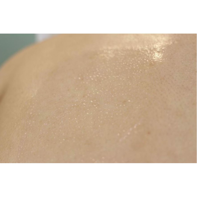 Sữa Dưỡng Thể Chăm Sóc Da Mụn, Mờ Thâm, Dưỡng Trắng Cho Cơ Thể Tiam Anti-Blemish | BigBuy360 - bigbuy360.vn