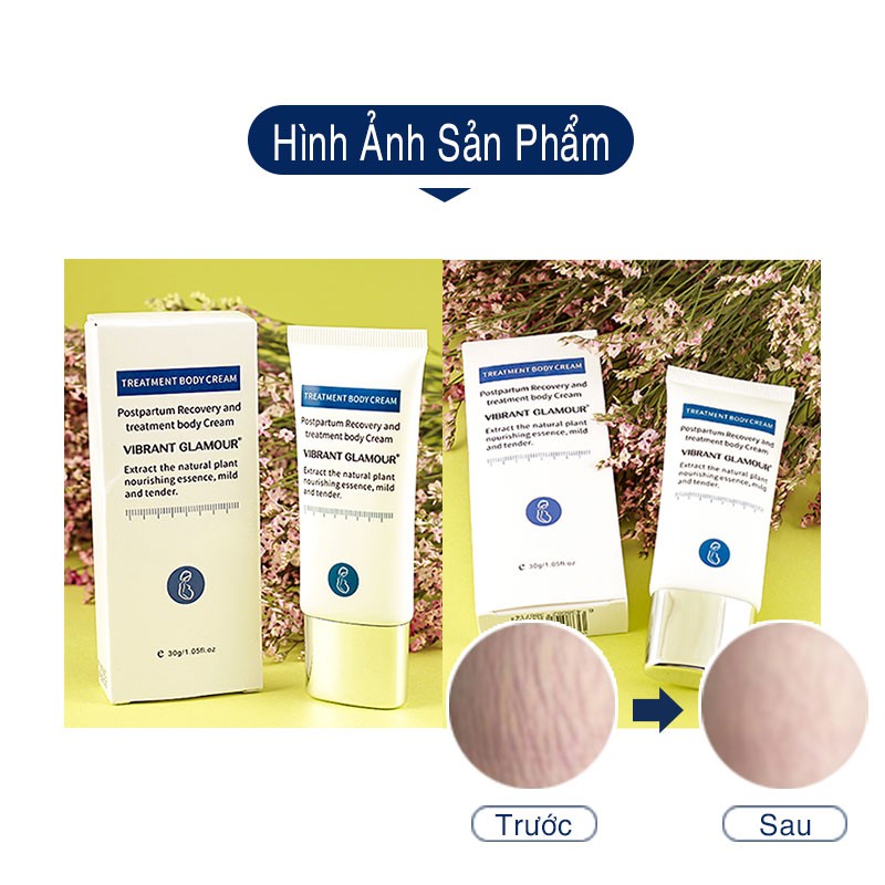 [Hàng Chính Hãng] VIBRANT GLAMOUR KEM LÀM MỜ RẠN DA SAU SINH & SẸO TÁI TẠO DA LÀM MỜ SẸO 30g