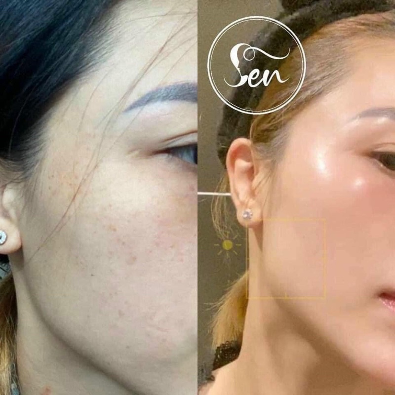 Tinh Chất Dưỡng Tái Tạo Da Dược Phẩm Sen - 30ML | BigBuy360 - bigbuy360.vn