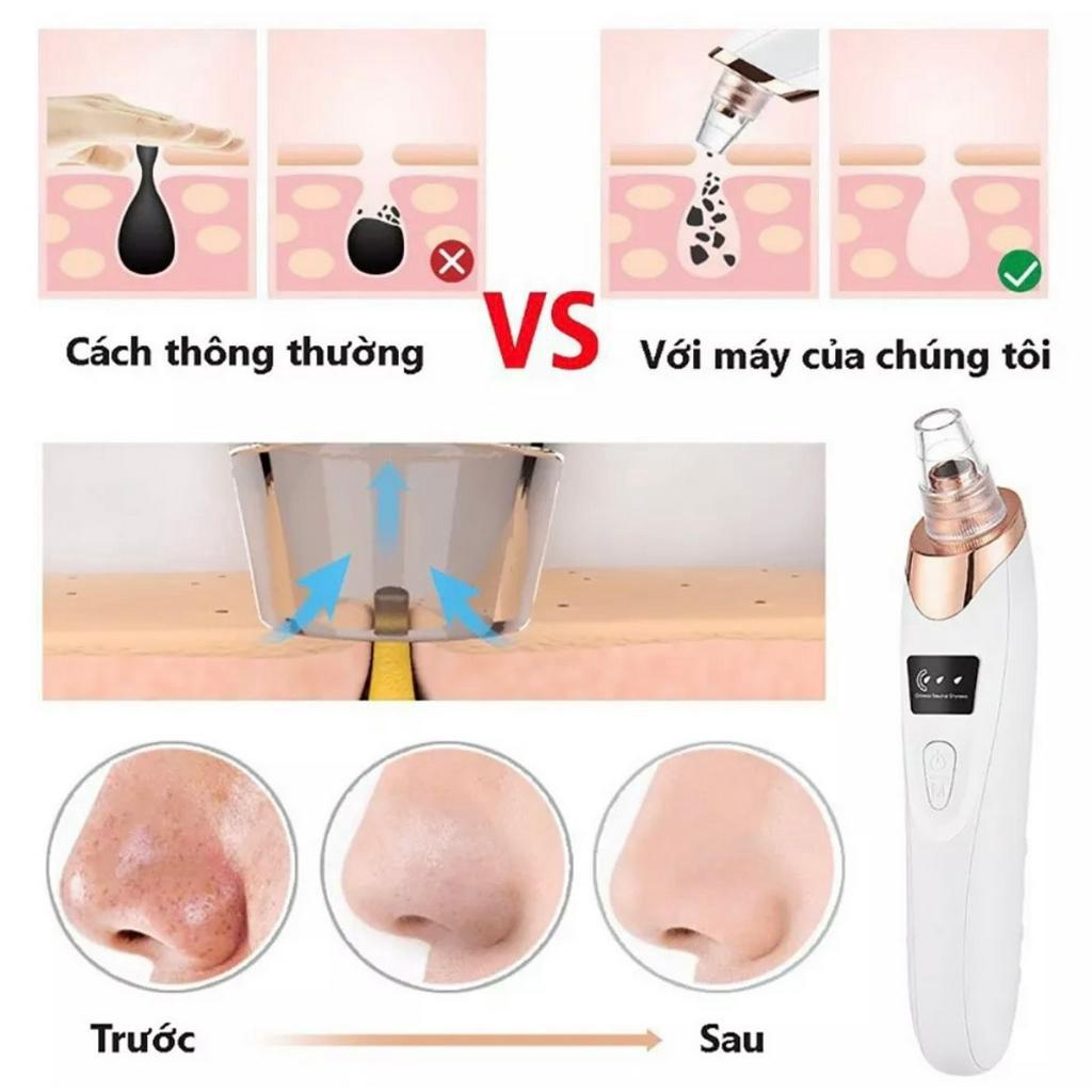 [Cao Cấp] Máy Hút Mụn Đầu Đen HY9, Máy Hút Mụn Cầm tay mini Có Màn Hình LED Kèm Với 5 Đầu Hút Cực Mạnh Hàng Công Ty