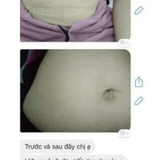 KEM TRỊ RẠN MULTI16