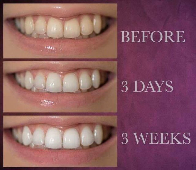 AP24 KEM ĐÁNH RĂNG TRẮNG RĂNG - Hàng xách tay của MỸ