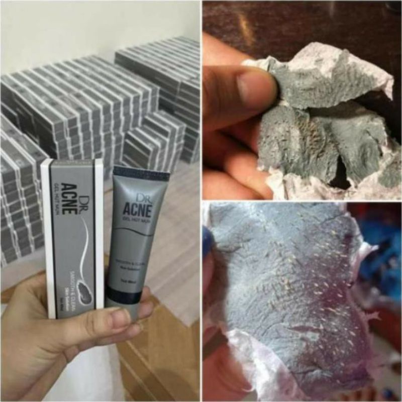 Gel Lột Mụn - DR.ACNE - Hút sạch mụn cám, mụn đầu đen. Thải độc chì- Sáng da