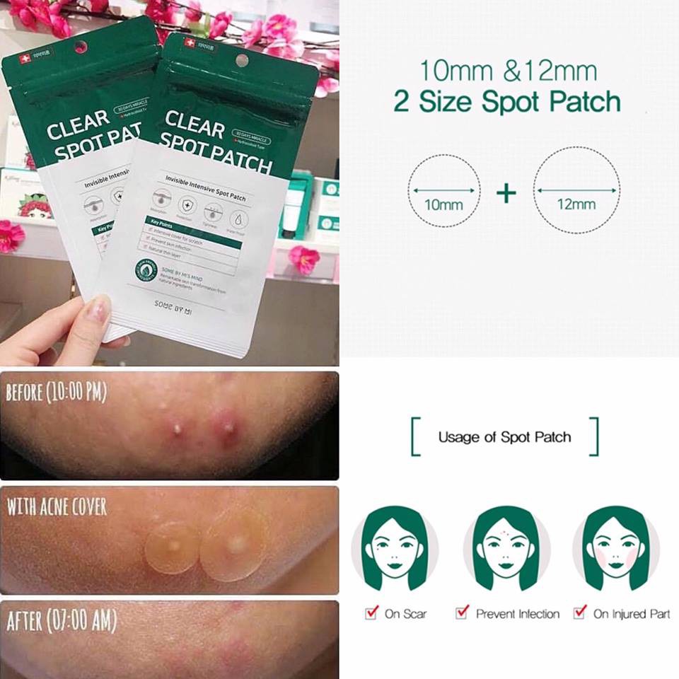 Miếng Dán Mụn Some By Mi Clear Spot Patch 18 Miếng/Gói