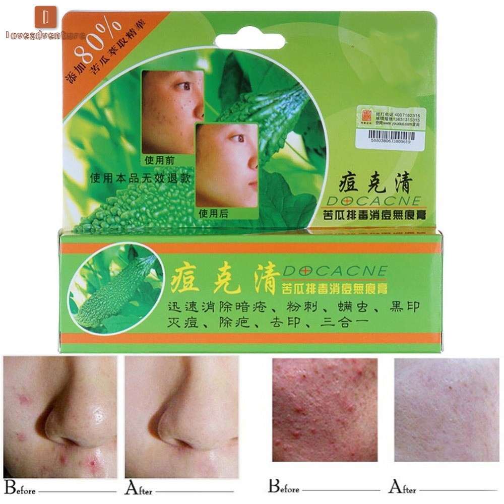 Kem Hỗ Trợ Giảm mụn / sẹo và kiềm dầu 30g nhãn hiệu DOCACNE | BigBuy360 - bigbuy360.vn