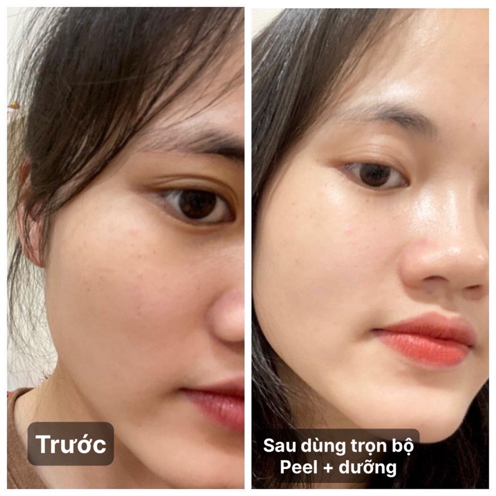 B-Tox Peel Da Vi Tảo Cao Cấp - Tái tạo da mặt tảo retinol tăng sinh collagen - pell để trẻ hóa tái sinh da mặt