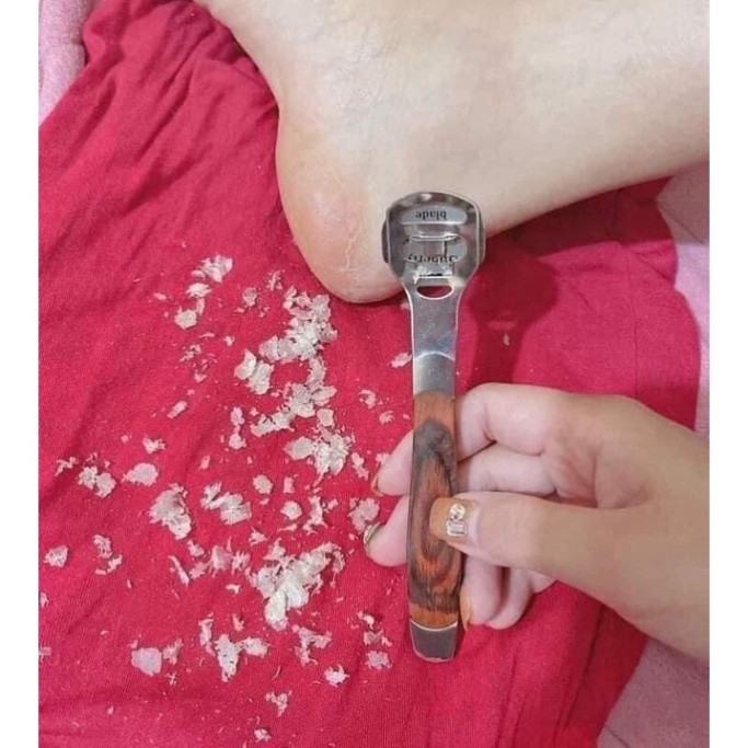 Bộ Dụng Cụ Tẩy Da Chết Chà Gót Chân Bằng Sắt Siêu Tiện Lợi