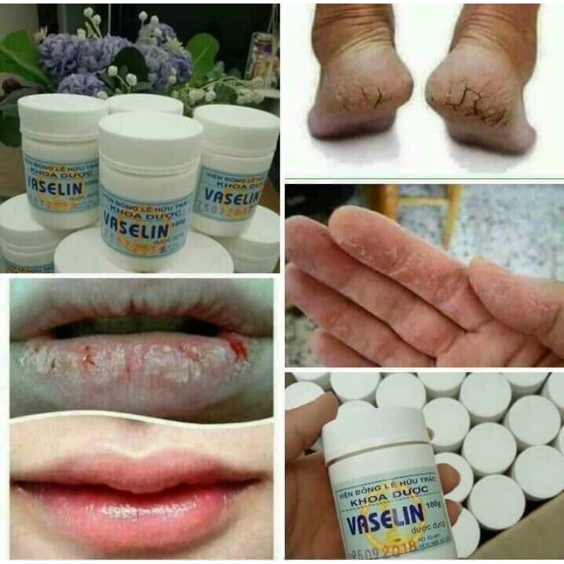 VASELIN VIỆN BỎNG QUỐC GIA