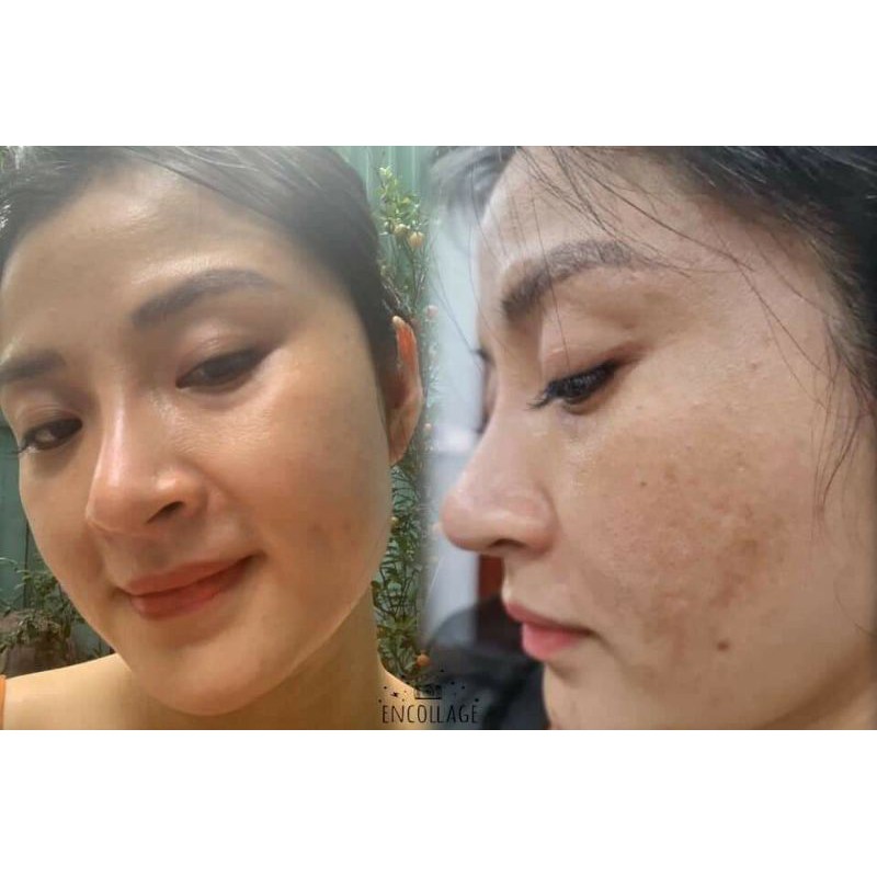 [CHÍNH HÃNG]Viên Uống Trắng Da NINE'S BEAUTY | BigBuy360 - bigbuy360.vn